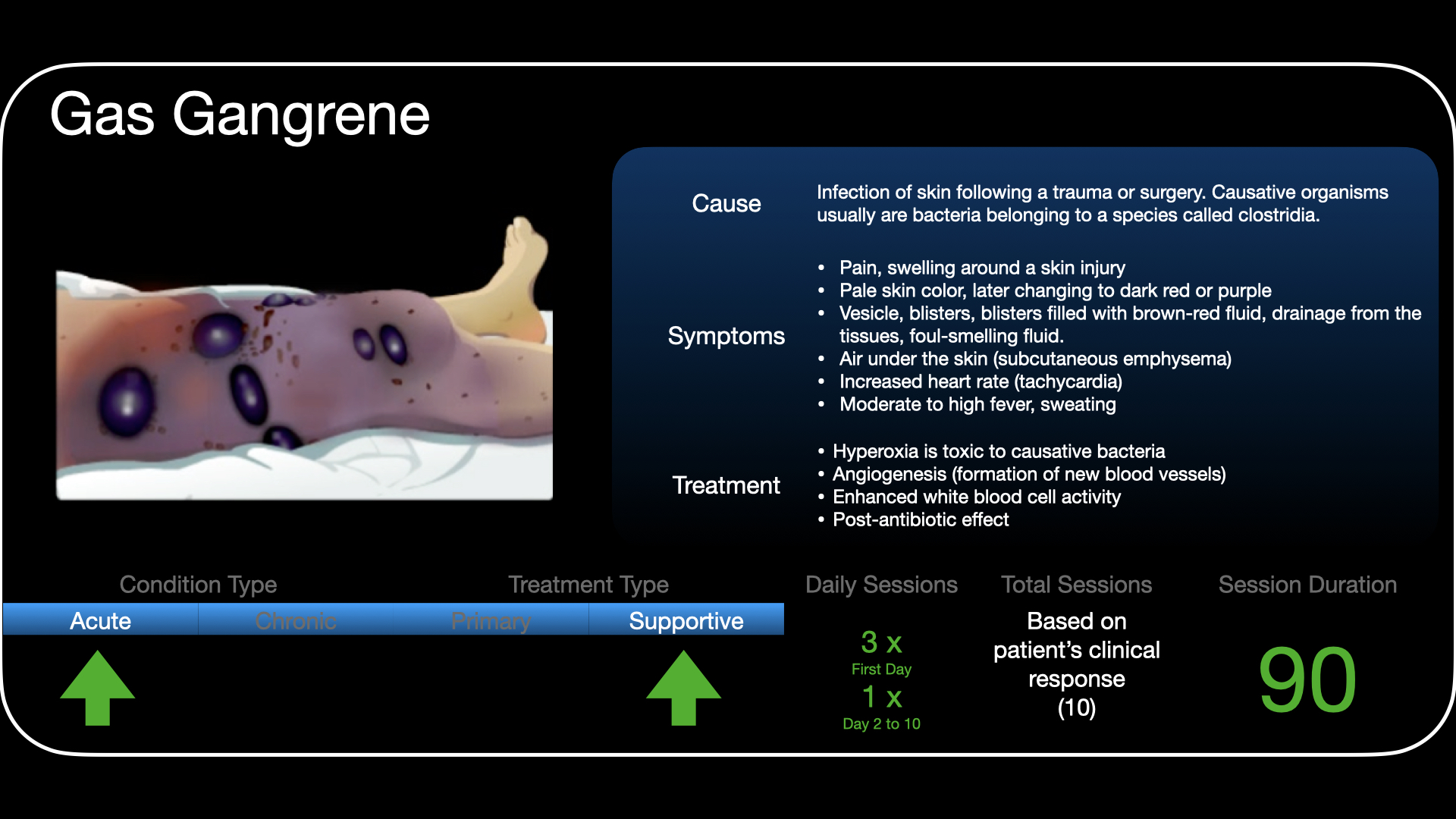 Gas Gangrene Rx